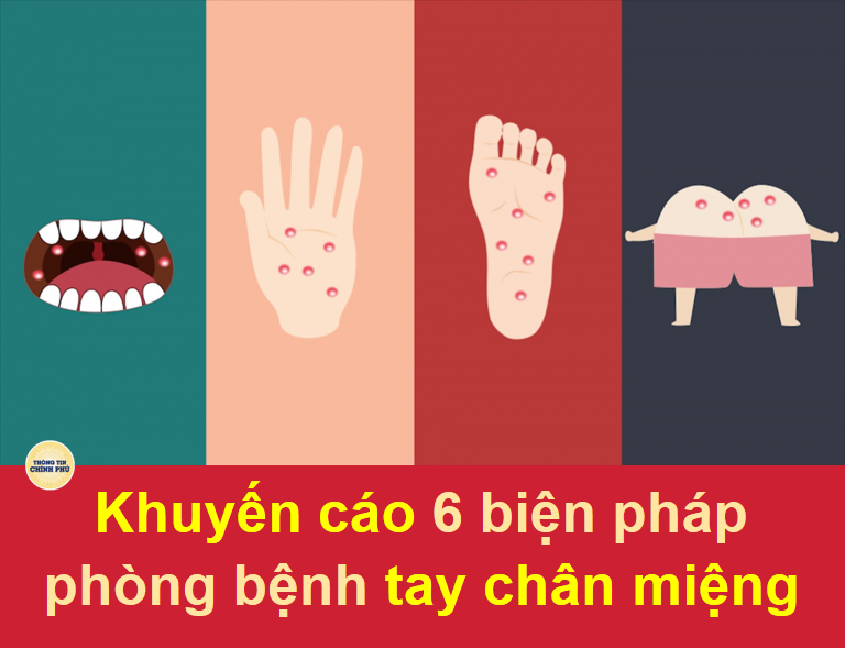 KHUYẾN CÁO PHÒNG BỆNH TAY CHÂN MIỆNG